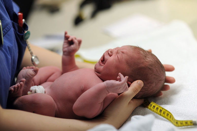 What is Caput Succedaneum?