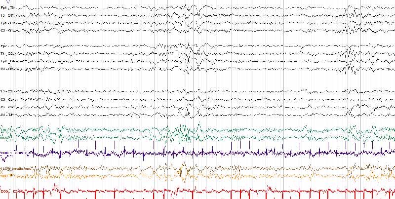 Newborn Sleep EEG