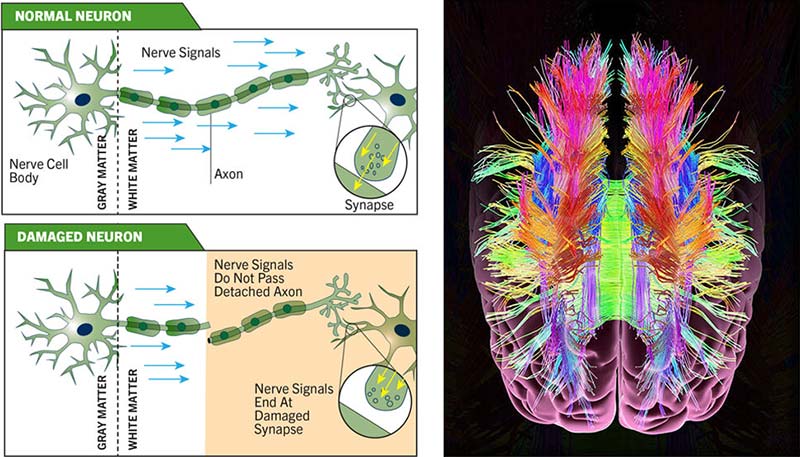 Brain Neurons