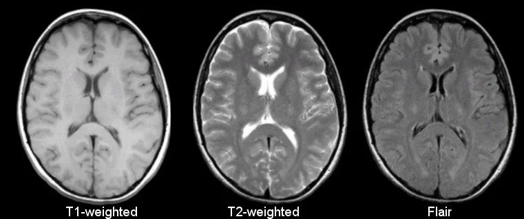 MRI weighted imaging