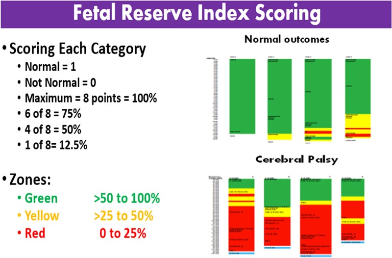 Fetal Reserve Index (FRI)