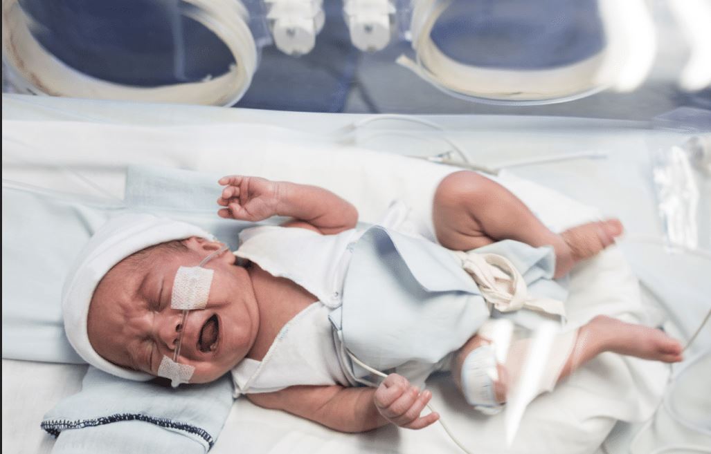 Baby in NICU Premature Birth