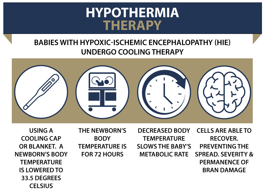 Hypoxic Ischemic Encephalopathy Process