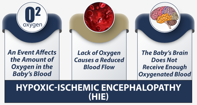 Five Misperceptions About Hypoxic-Ischemic Encephalopathy (HIE)