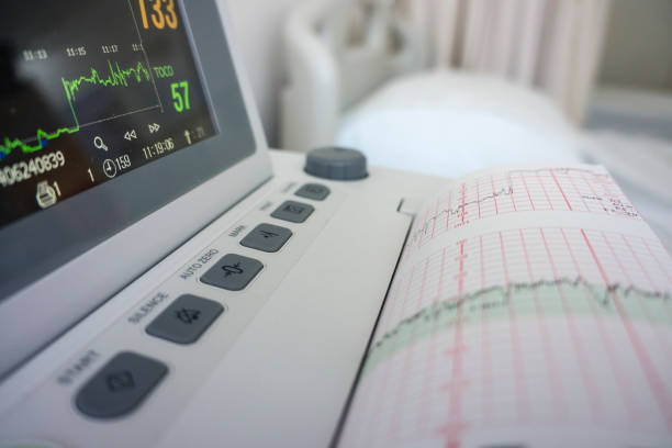 fetal heart rate monitoring