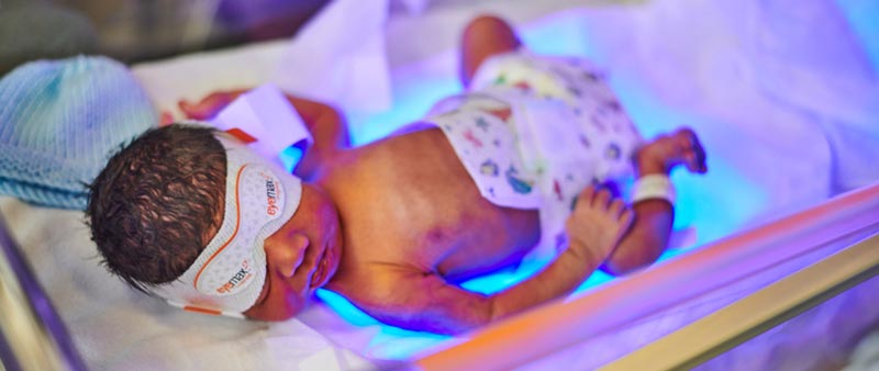 Fiber Optic Blanket Newborn Jaundice