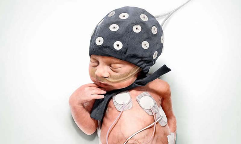 neonatal brain activity eeg