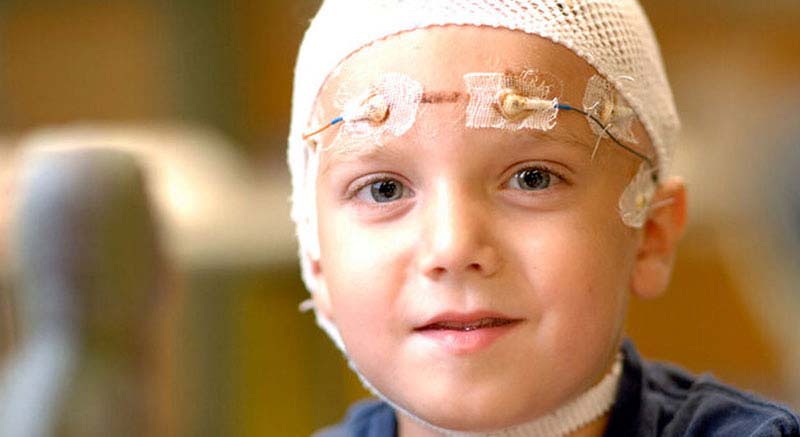 EEG Scanning for Epilepsy