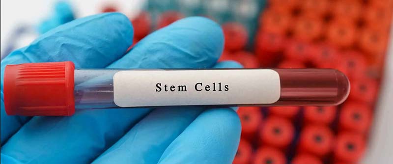 umbilical cord blood stem cells