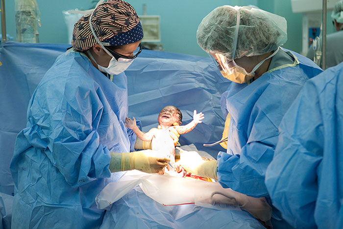 C-section complications