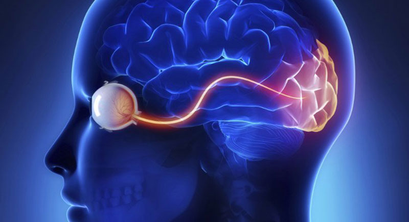 Cortical Visual Impairment (CVI)