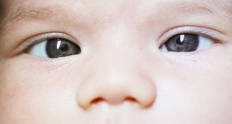 Signs of Vision Problems in Infants